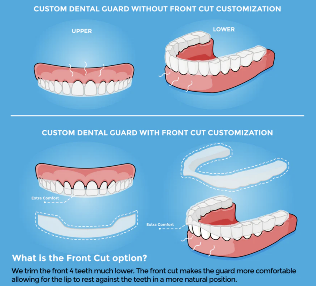 Custom Dental Nightguard